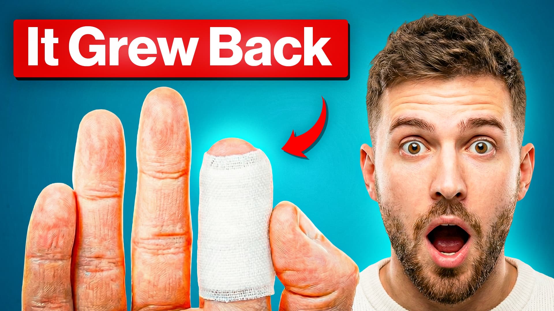 Standard package thumbnail example 006